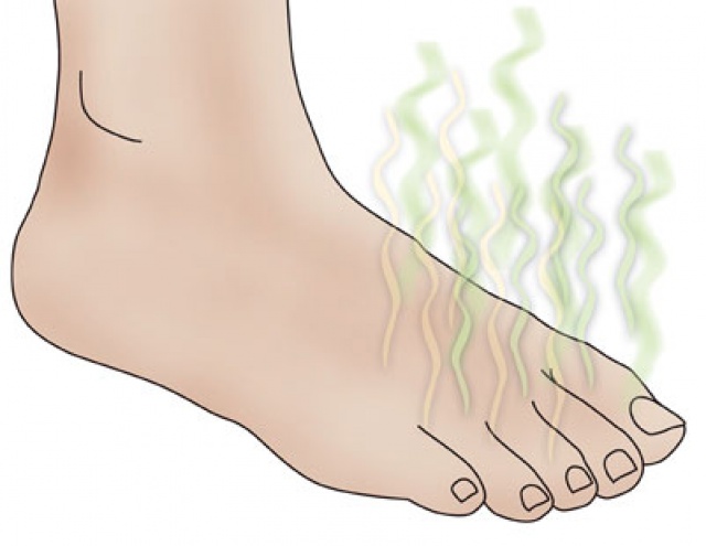 Як видалити неприємний запах поту у взутті? » журнал здоров'я iHealth 
