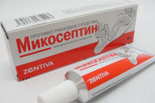 Грибок ногтей на ногах ламизил