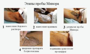 Проба Минора