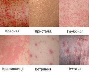 Виды патологии