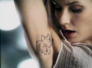 гипергидроз подмышек