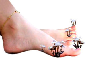 если ступня поражена грибками-дерматофитами