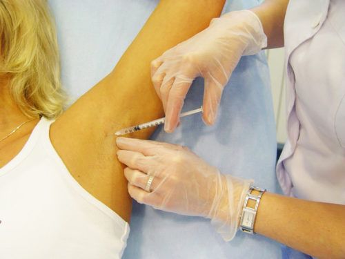 Ботокс от потливости