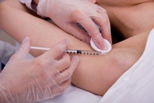 Непосредственно процедура