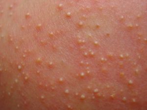 Кристаллическая потница