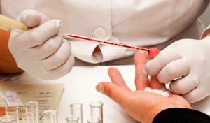 Диагностика обильного потоотделения