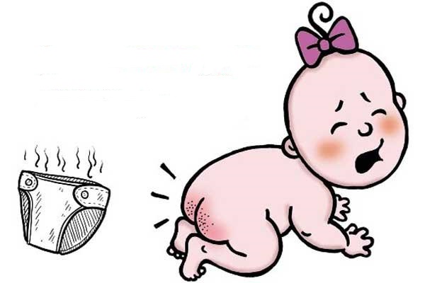 Опрелость у новорожденных