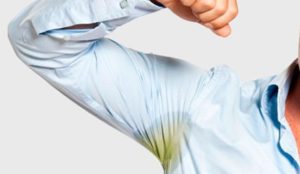 Что является причиной обильного потоотделения