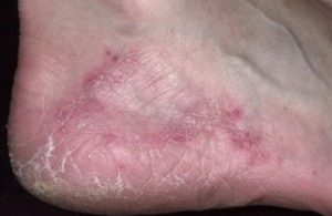 Сущность патологии