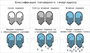 Пальмарный вид