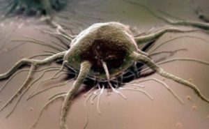 Причины появления дистального гипергидроза