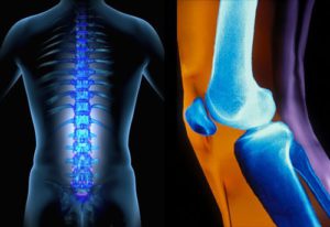 ревматизм как причина