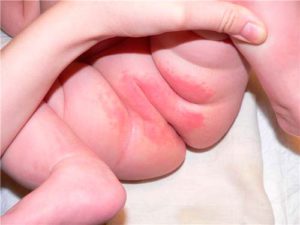 В каких случаях применять