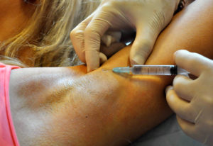 Локальные операции