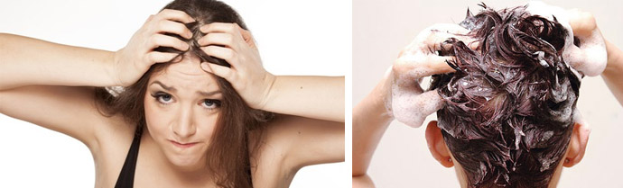 Лечение гипергидроза