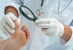 Лечение онихомикоза