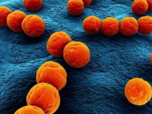 стрептококки