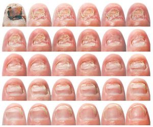 Общие признаки заболевания