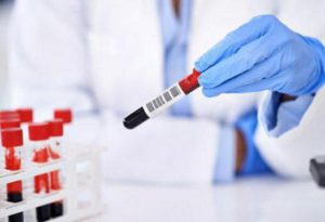 анализ крови 