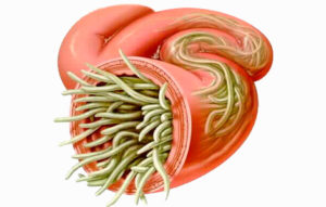 очищение кишечника от различных паразитов