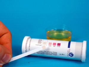 Что предпринять при запахе ацетона