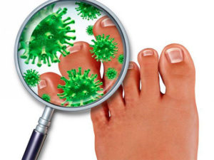 Профилактика грибка