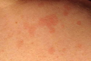 Когда разрешается