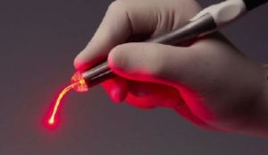 Как и каким оборудованием проводится процедура