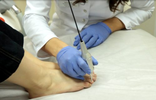 Как сдать анализ на грибок ногтей