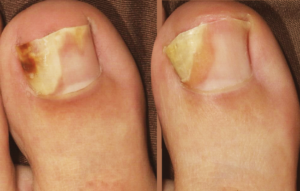 симптоматика