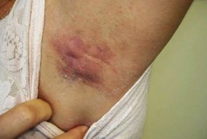 Когда еще раствор будет полезен