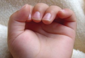 Как применять средство при лечении онихомикоза