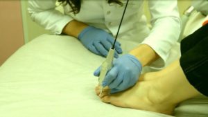 анализ ногтевой пластины