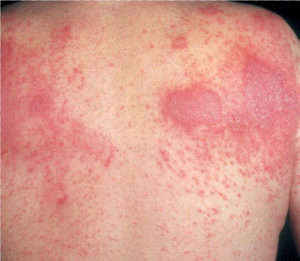 Показания к применению