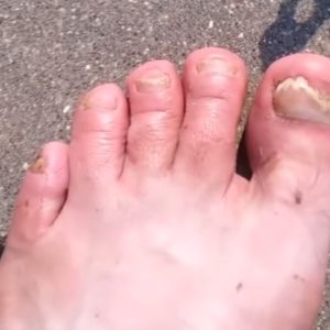 Что такое приливы. Их признаки