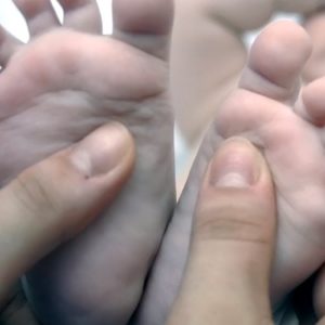 грибок ногтей у детей